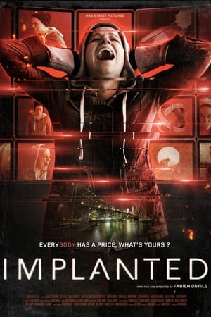 Implantas